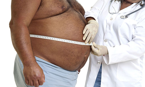 Связь ожирения и сахарного диабета