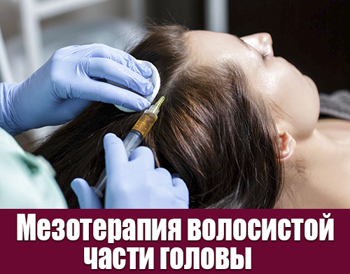 Мезотерапия волос в Ростове-на-Дону
